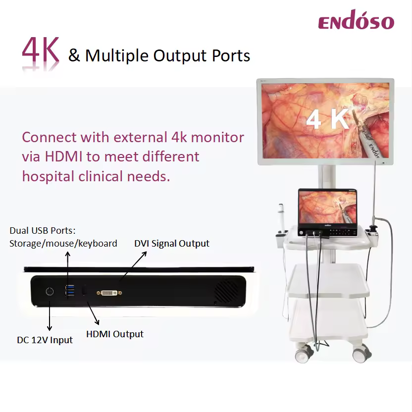 ชุดส่องกล้องรวมระบบประมวลสัญญาณภาพ 4K