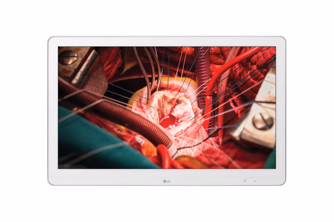 หน้าจอแสดงผลภาพทางการแพทย์ LG 27HK510S