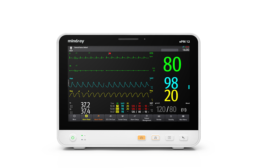เครื่องติดตามการทำงานของหัวใจและสัญญาณชีพ Mindray